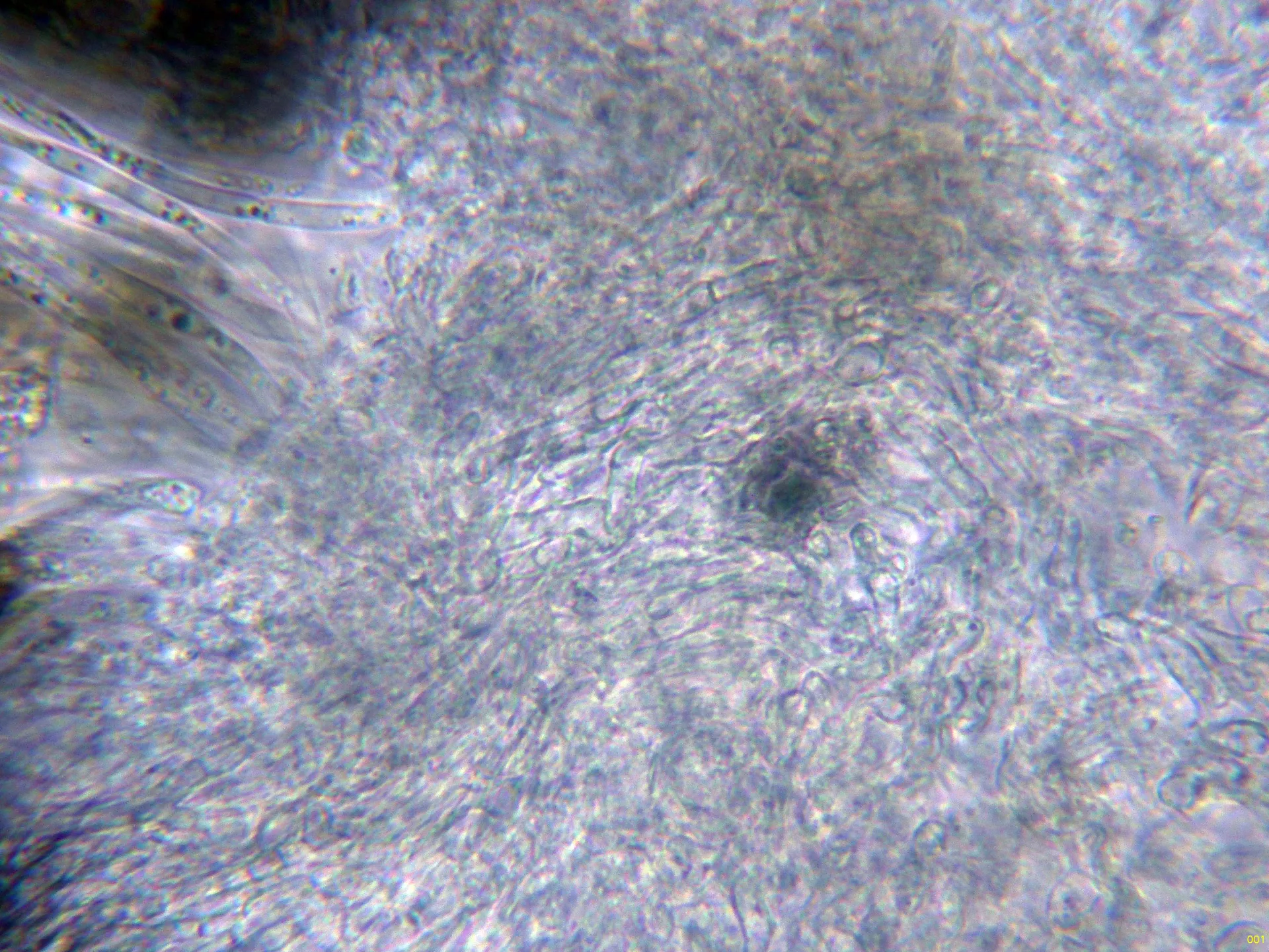 Microscopía de Lophiostoma compressum - 12 - Excípulo agua-001